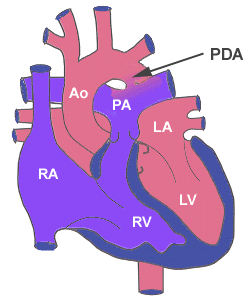  PDA